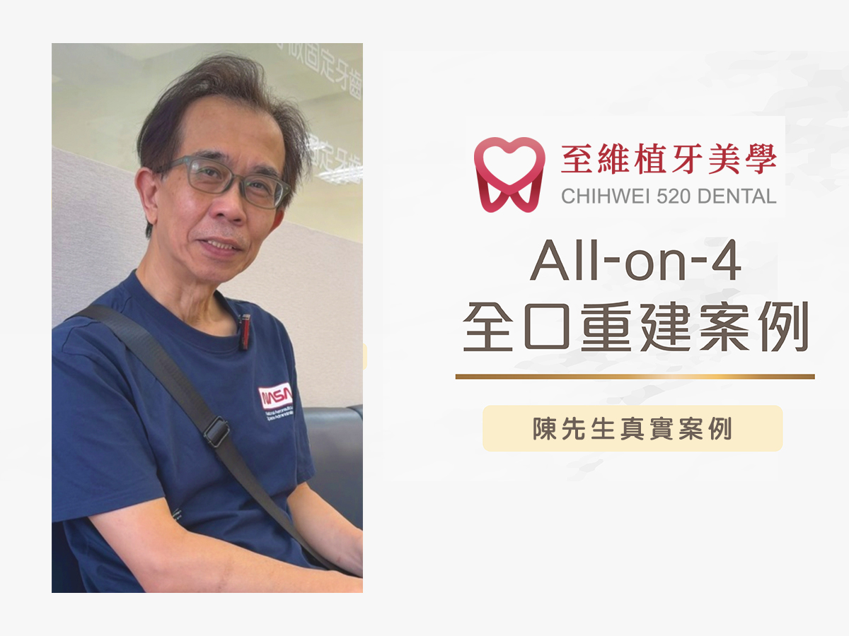 All-on-4真實案例分享：6小時重建下顎，告別缺牙，重拾美食樂趣！