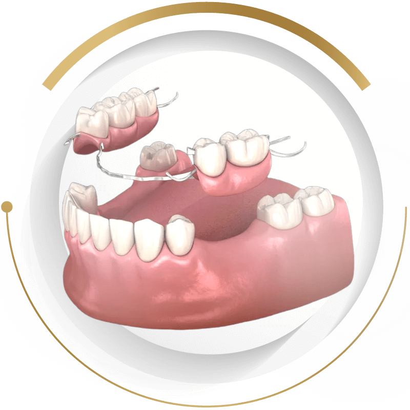 至維牙醫診所_活動假牙 (傳統假牙)