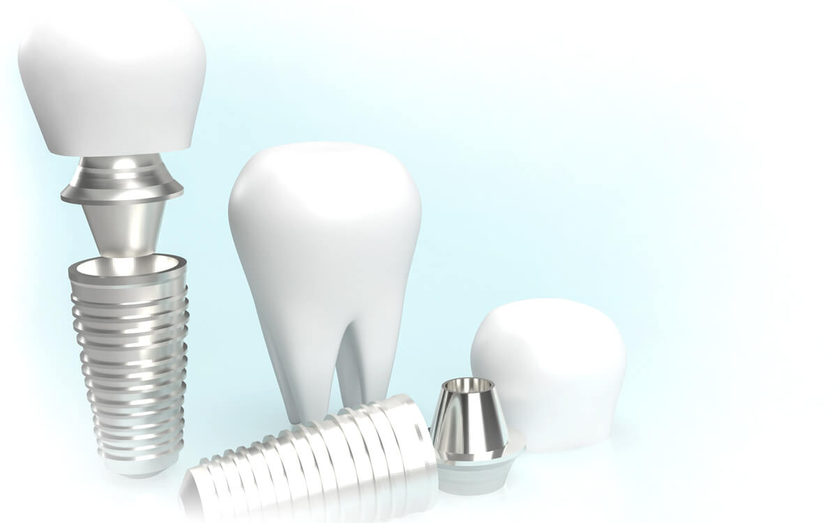 至維牙醫診所_微創植牙