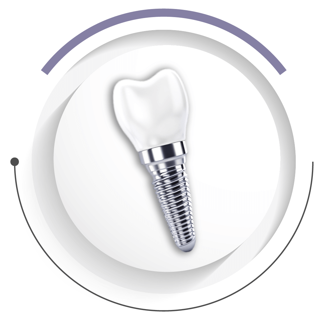 至維牙醫診所_全口重建_傳統全口植牙